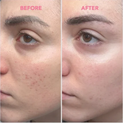 TEA GLOW BLEMISH CREAM