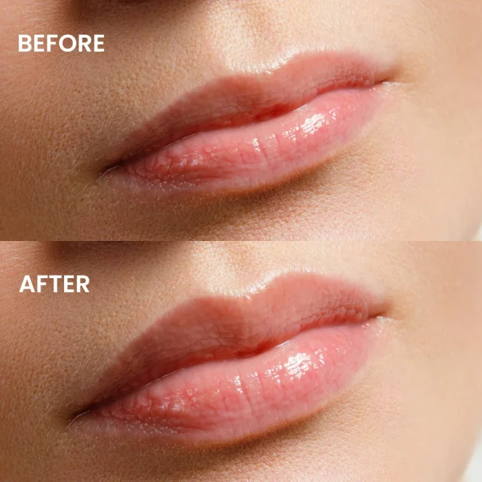 HYPE LIP 10 Supernova - 4,7 ml